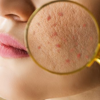 Suraksha Hospital Dermatology